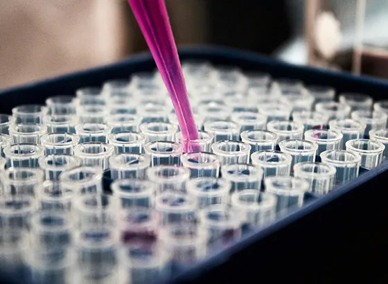 PJP (Pneumocystis Jirovecii Pneumonia) Quick-Reference