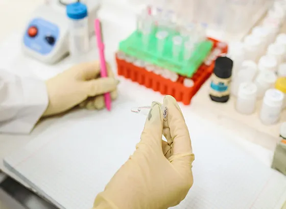 Dialysis Fluid Medical Endotoxin Detection Kit: A Critical Line of Defense for Dialysis Patient Safety