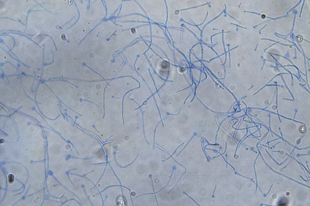 Talaromyces Marneffei (Talaromycosis) Quick-Reference