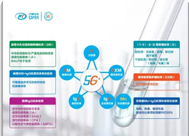 5G+ TIME IS COMING...